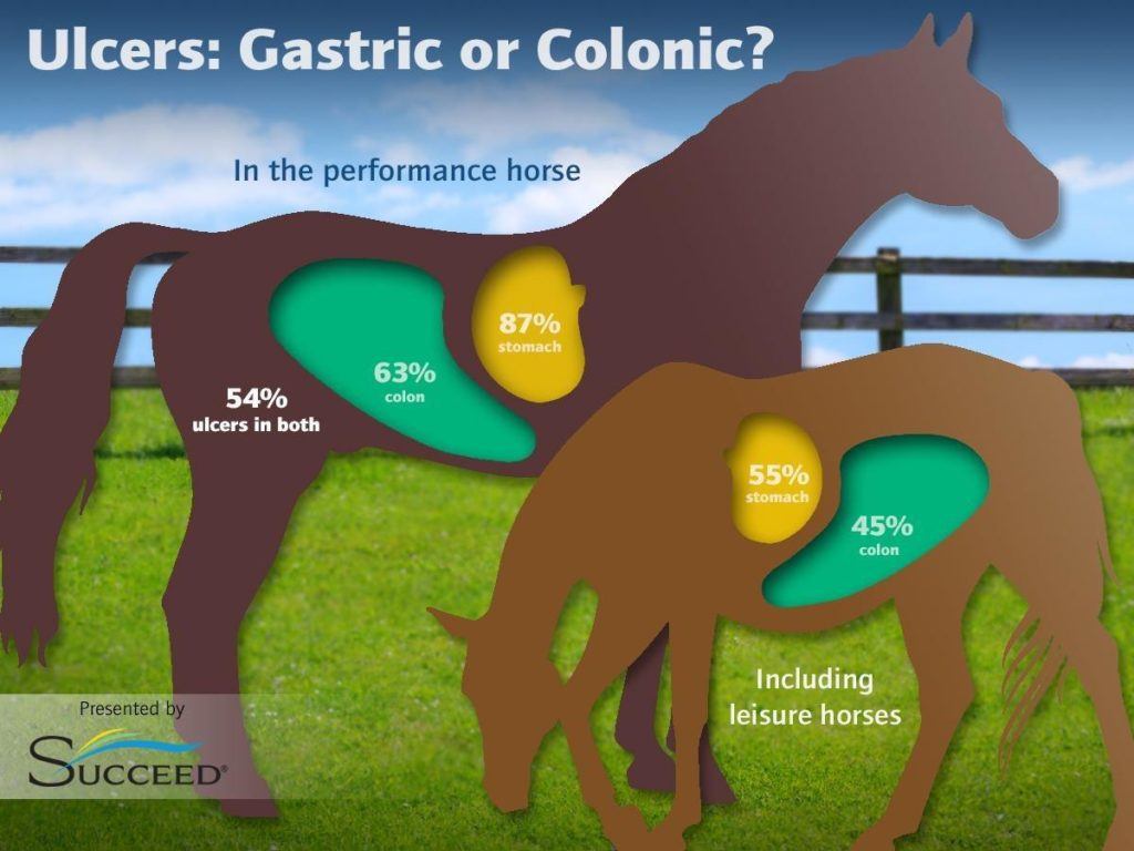 ulcers gastric or colonic